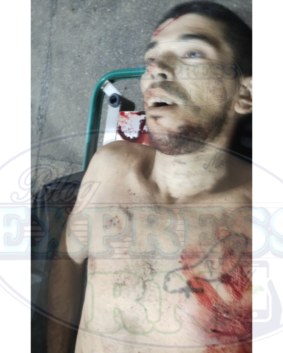 FOTOS EXCLUSIVAS: Na Zona Norte, membros do Sindicato do Crime atiram em uma viatura; um deles é baleado, socorrido e morre após dar entrada na unidade hospitalar. 